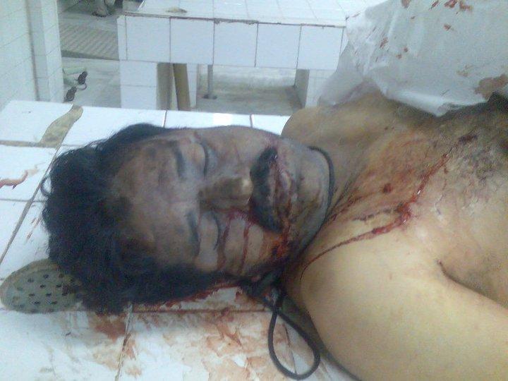 shiitenews-haider-ali-martyred-by-wahabi-terrorist