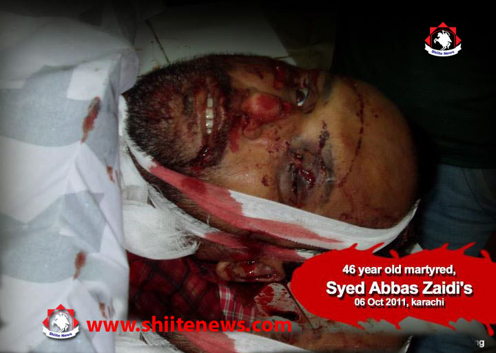 Karachi: Abbas Zaidi gunned down by Terrorist