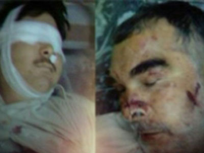 shiitenews quetta shaheeed