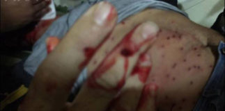 10947203_793347867368520_75