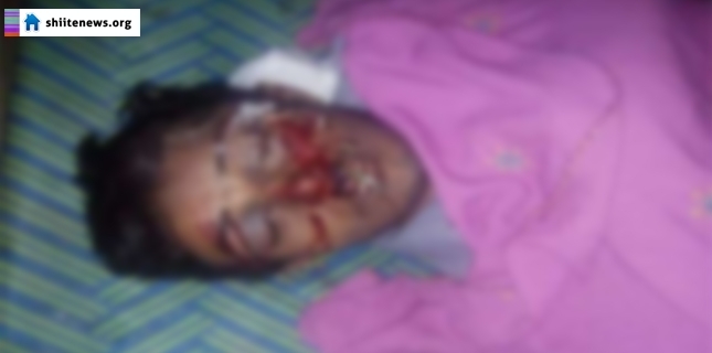 Handicapped son of a Shia cleric gunned down in Dera Ismail Khan