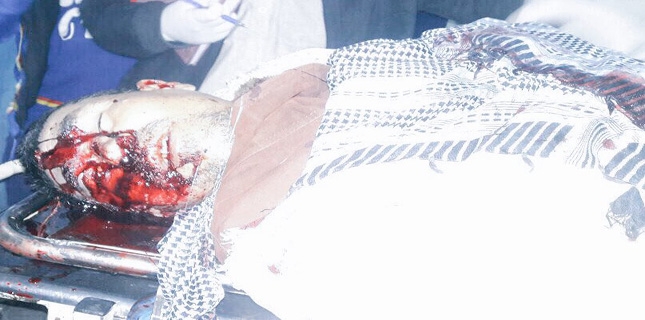 Shia Muslim martyred due to ASWJ terrorists firing in Quetta