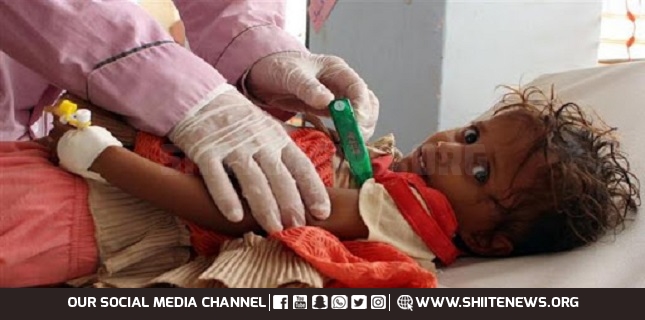 Yemen’s Horrible Health Situation By Statistics
