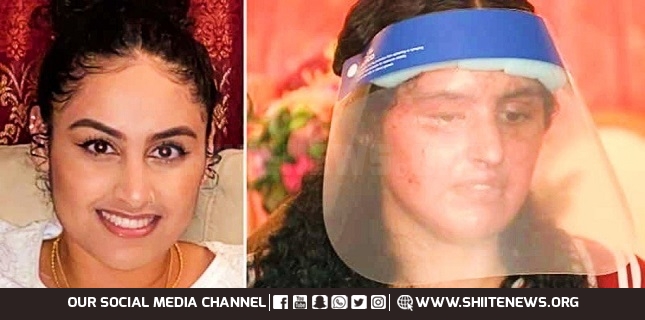 Muslim woman burned in acid attack in New York in another hate crime