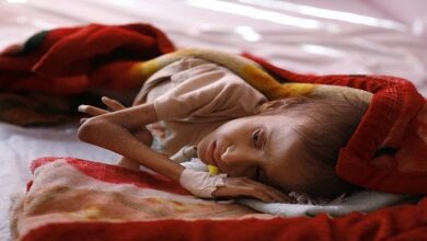 Rights organization says 300 Yemeni children die every day because of malnutrition