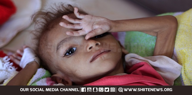 Yemen suffers the world's worst epidemic disaster