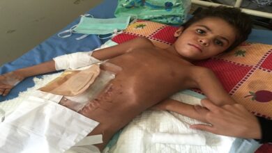 Saudi cluster bombs injure 10 Yemeni children