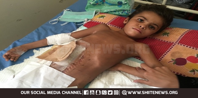Saudi cluster bombs injure 10 Yemeni children