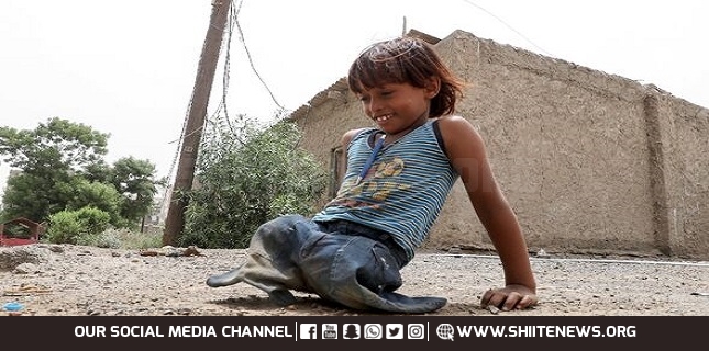 Mine blast injures 12 Yemeni people, including 9 children