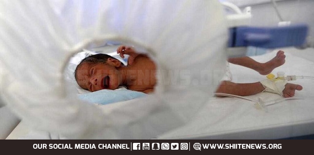Over 80 Yemeni newborns lose their lives every day due to Saudi-led war
