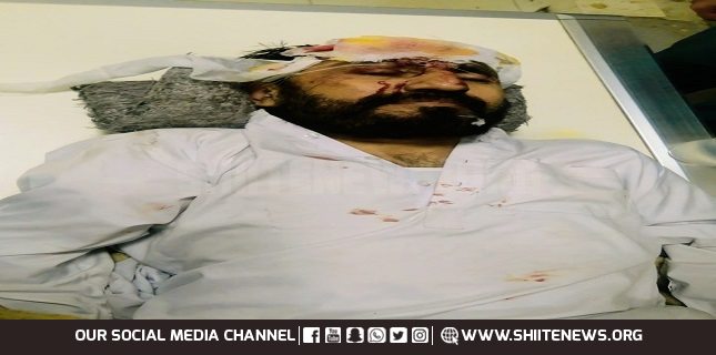 MWM leader seriously injured in a traffic accident